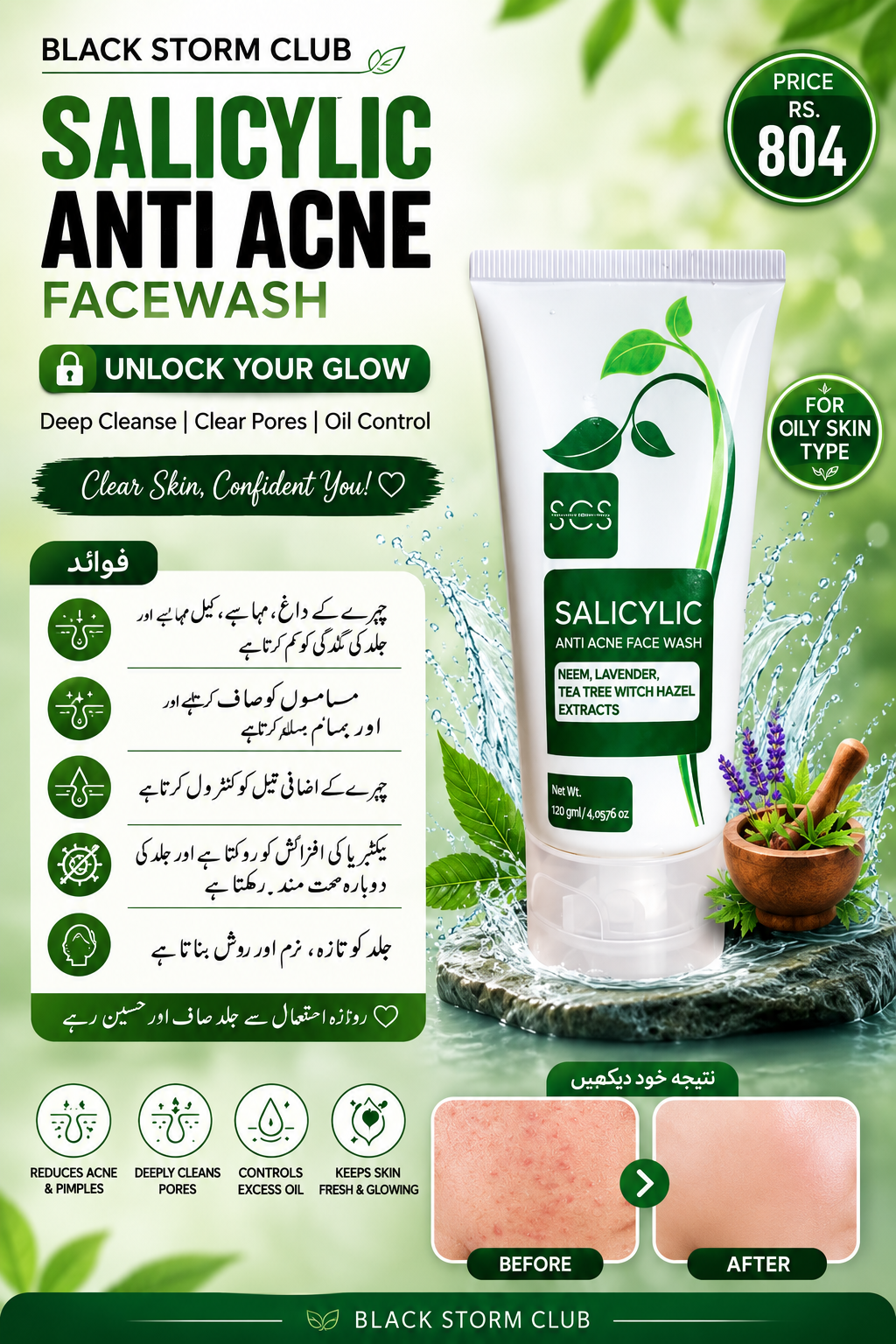 Salicylic Anti Acne Face Wash